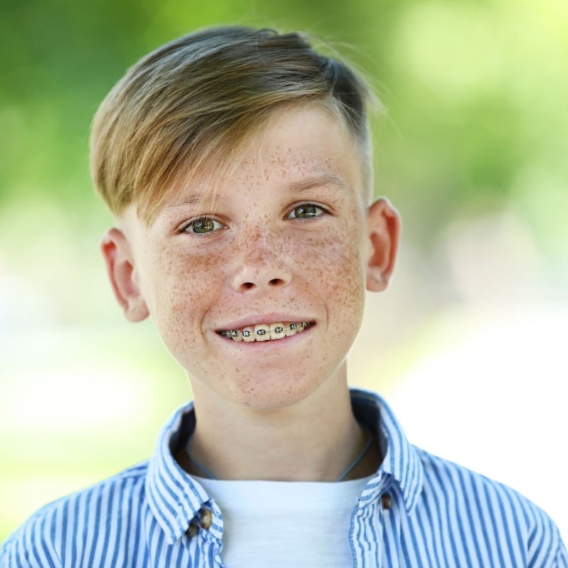 Traditional Metal Braces in Lufkin and Nacogdoches, Clear Ceramic Braces in Lufkin and Nacogdoches