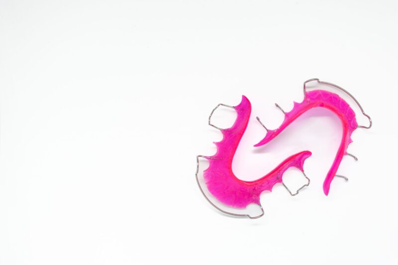 Pink removable orthodontic appliance with metal clasps